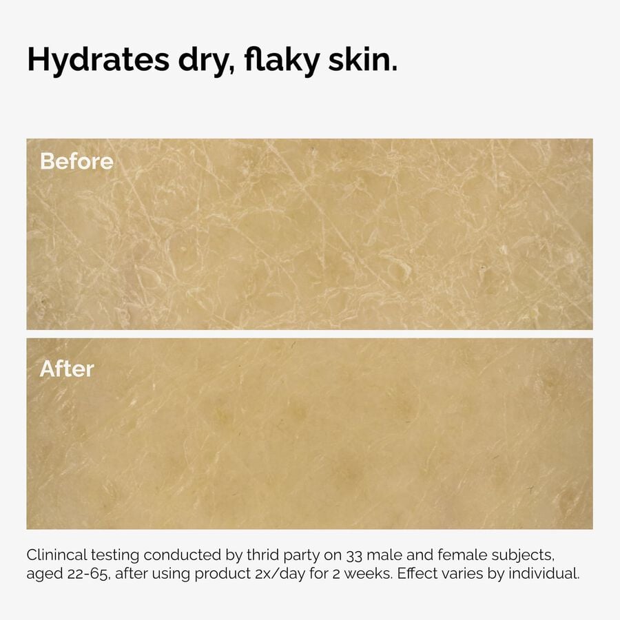 the-body-care-collection-x1 ord-natural-moisturizing-factors-inulin-body-before-after-graphic-02.jpg