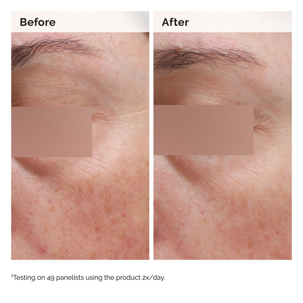 niacinamide-5-face-and-body-emulsion-o7 2024-08-23-ORD-Nia-5pct-Face-Body-B-A-Elasticity-Global-02-1x1.jpg