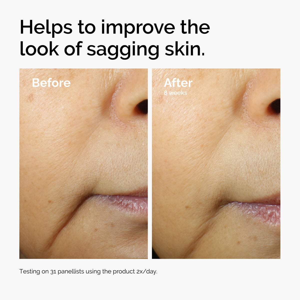 caffeine-3-escin-1-face-serum-r1 ord-caffeine-3pct-escin-1pct-face-serum-before-after-sagging.jpg