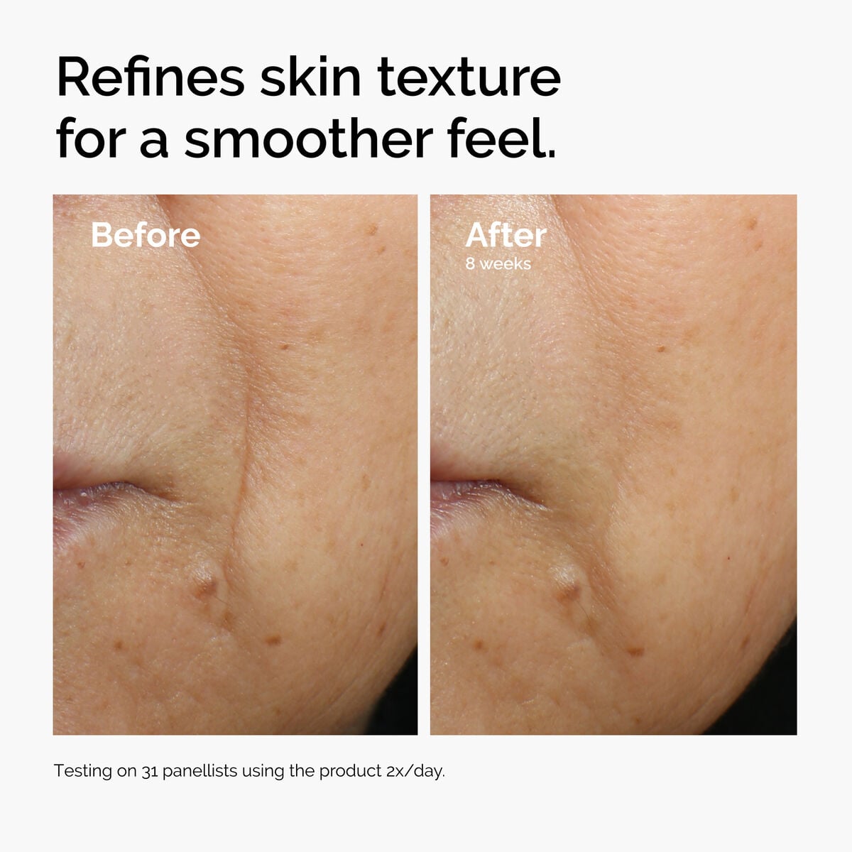 caffeine-3-escin-1-face-serum-r1 ord-caffeine-3pct-escin-1pct-face-serum-before-after-texture.jpg