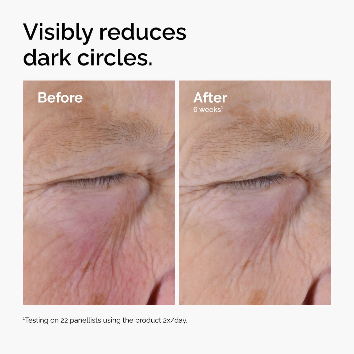 caffeine-solution-5-egcg-eye-serum-a5 ord-caffeine-solution-egcg-dark-circles-before-after.jpg
