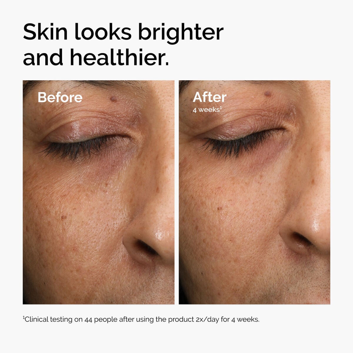 multi-antioxidant-radiance-serum-x1 ord-mars-before-after-healthy.jpg