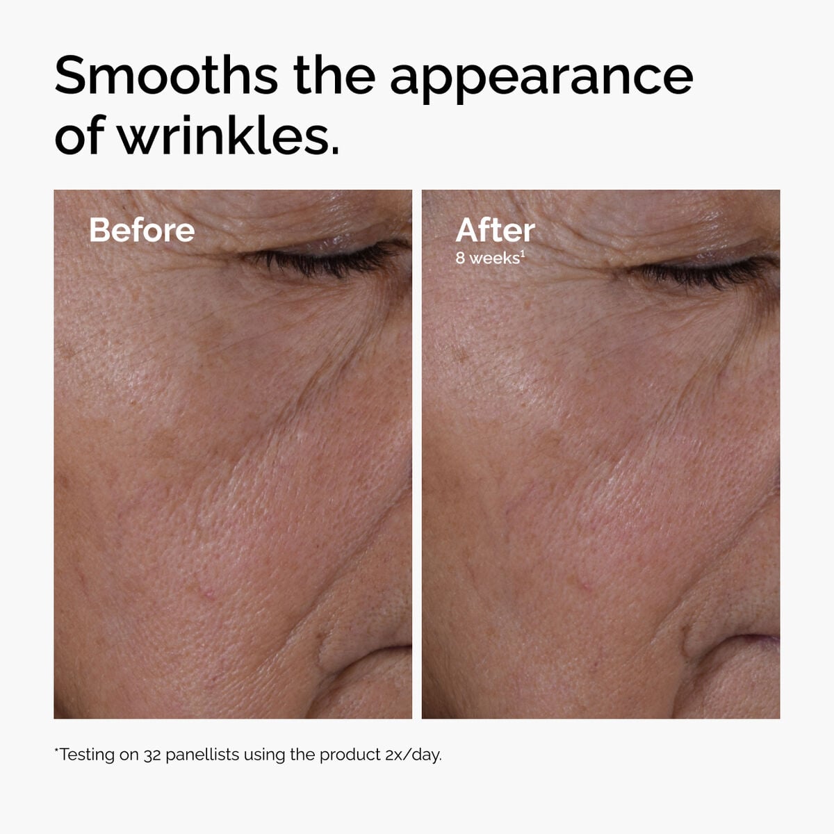 multi-peptide-ha-serum-v5 ord-multi-peptide-ha-serum-wrinkles-before-after.jpg