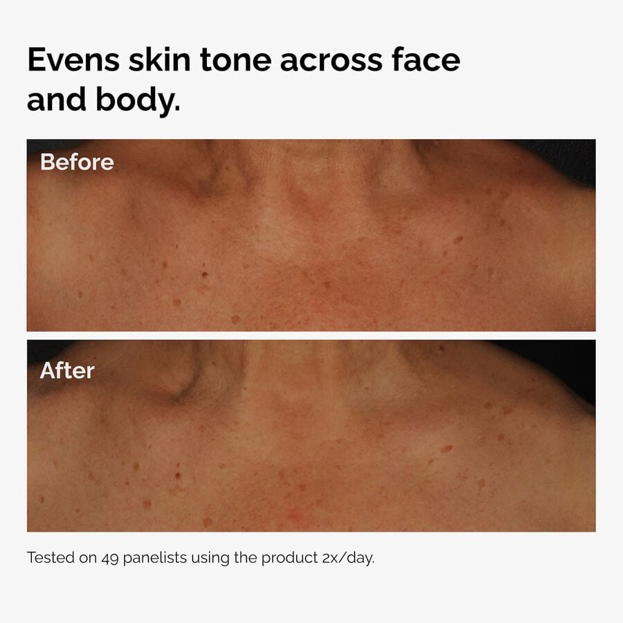 the-body-care-collection-x1 ord-niacinamide-face-body-serum-before-after-even-tone-graphic.jpg