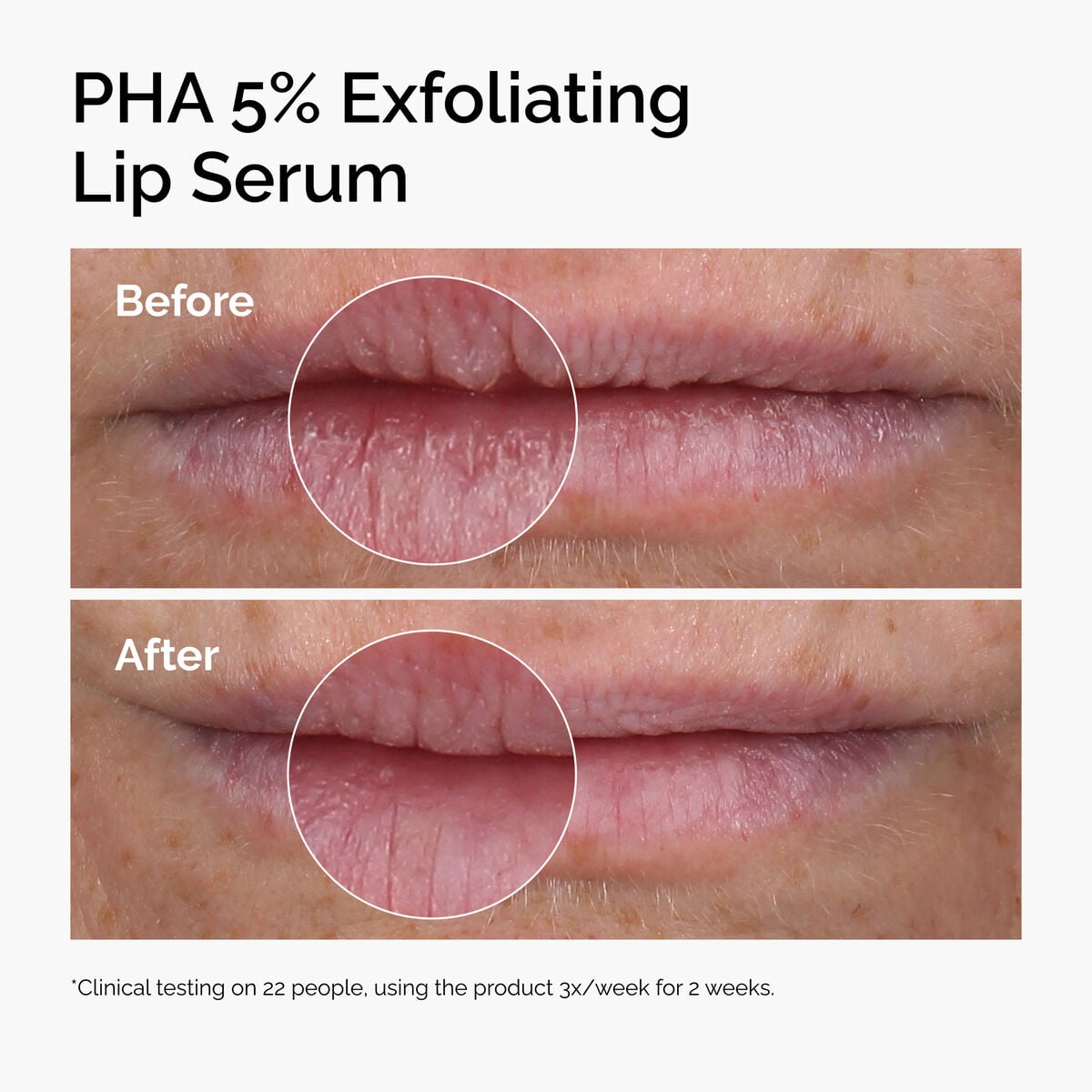 pha-5-exfoliating-lip-serum-m3 ord-pha-5pct-lip-exfoliating-serum-before-after.jpg